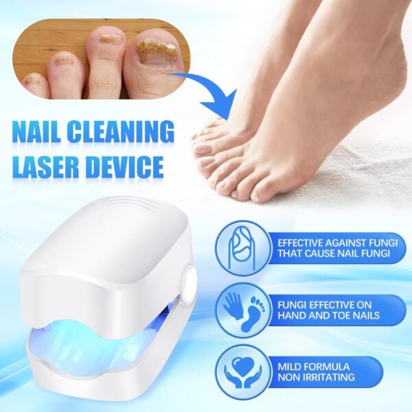 Rechargeable Nail Fungus Laser ? Anti-Fungal Device for Toenails, Hands & Feet - Image 3